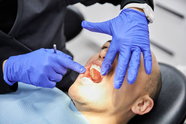 Best Emergency Tooth Extraction in Antwerp, OH